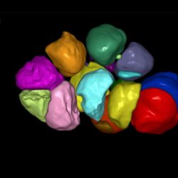 Фолликулометрия SonoAVCFfolicle - метод 3D автоматизированного подсчета количества фолликулов в каждом яичнике 